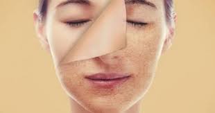 ماسك الوجه لتنظيف البشرة الحساسة: الحل الفعال للعناية ببشرتك