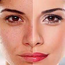 أفضل 5 منتجات الوجه لتحسين مظهر بشرتك